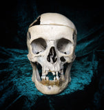 Medically prepared human skull