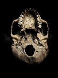 Human skull