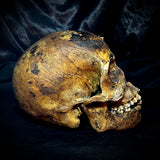 Item 11. Human skull with mandible