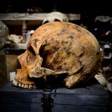 Human skull
