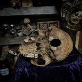Human skull