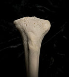 Human tibia (shinbone)