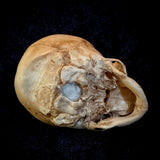 Item 1. Human fetal skull