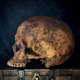 Item 8. Human skull