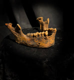 A mandible