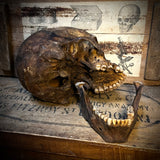 Human skull with mandible