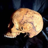 Item 15. Human skull