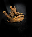 A mandible