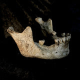 A mandible