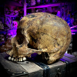 Human skull