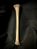 Human tibia (shinbone)