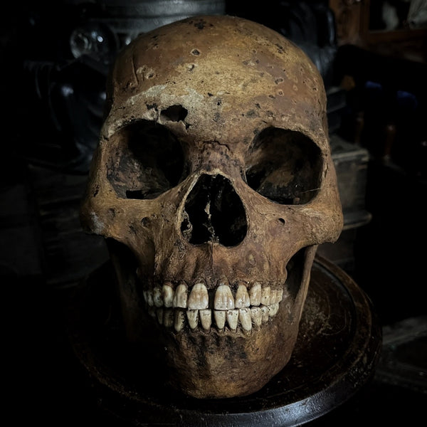 Human skull