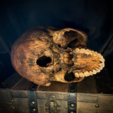 Item 8. Human skull