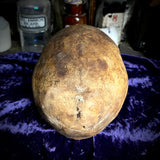 Human skull