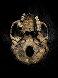 Human skull