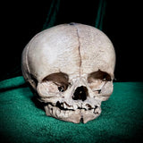 Human fetal skull