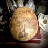 Human skull with mandible