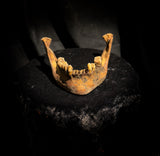 A mandible