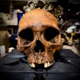 Human skull