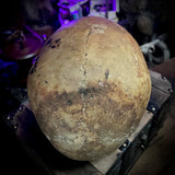Human skull
