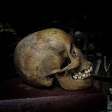Human skull