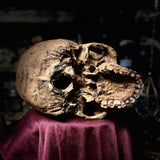 Human skull