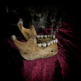 A mandible