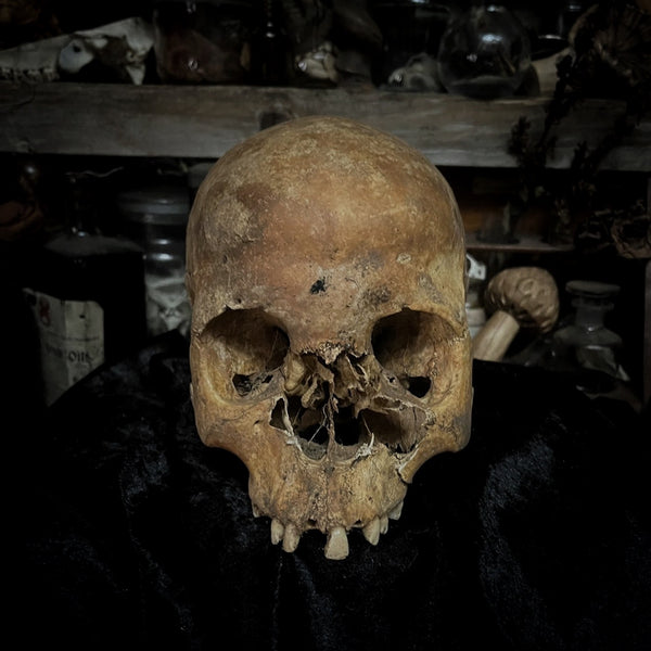 Human skull