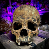 Human skull
