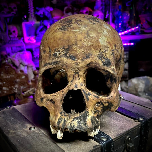 Human skull