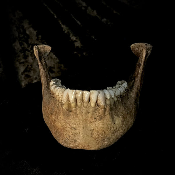 A mandible
