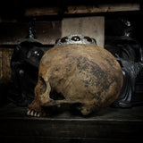 Human skull