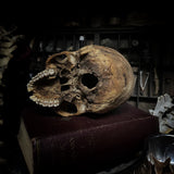Human skull