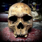Human skull