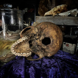 Human skull