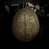 Human skull
