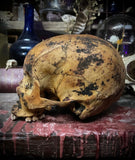 Human skull