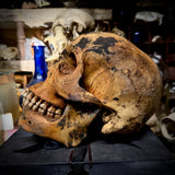 Human skull with mandible