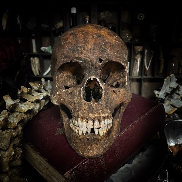 Human skull