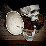 Medically prepared human skull