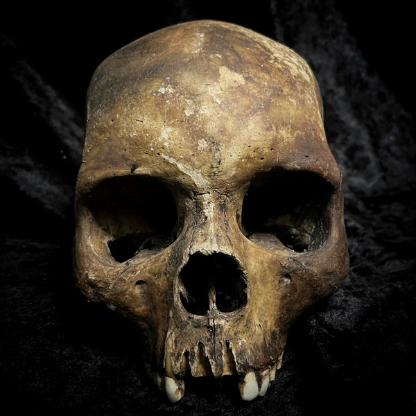 Human skull