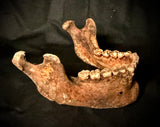 Item 10. Human mandible