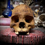 Human skull