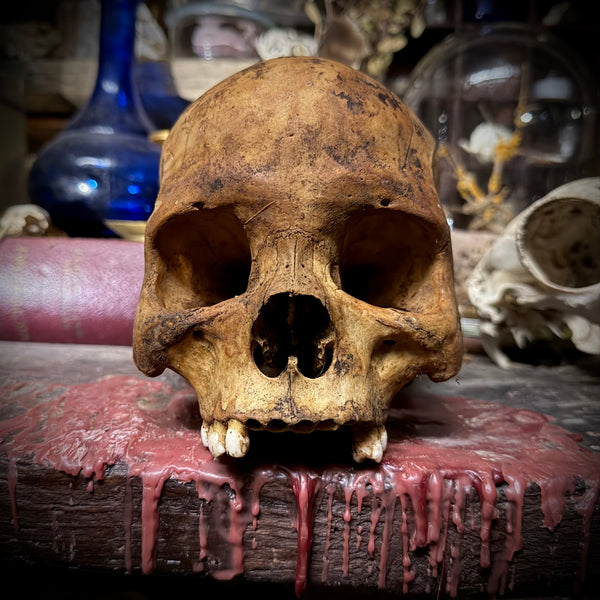 Human skull
