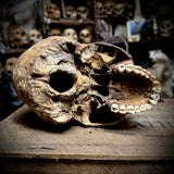 Human skull
