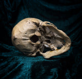 Medically prepared human skull