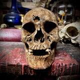 Human skull