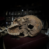 Human skull