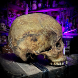 Human skull