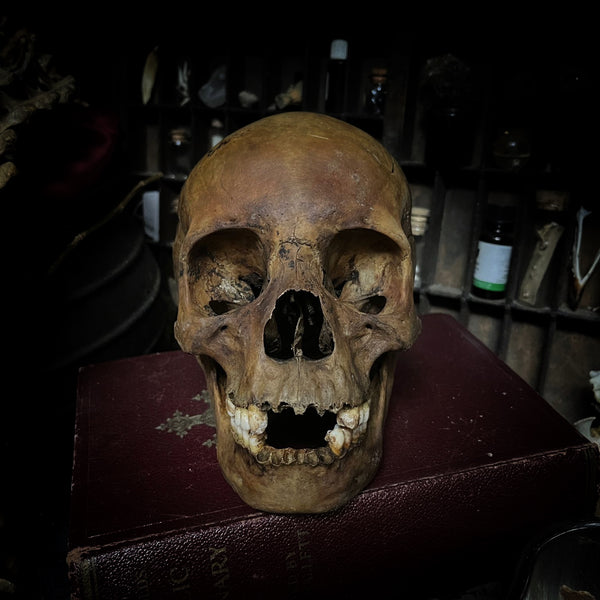 Human skull